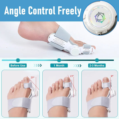 Eicgo Bunion Corrector for Women & Men