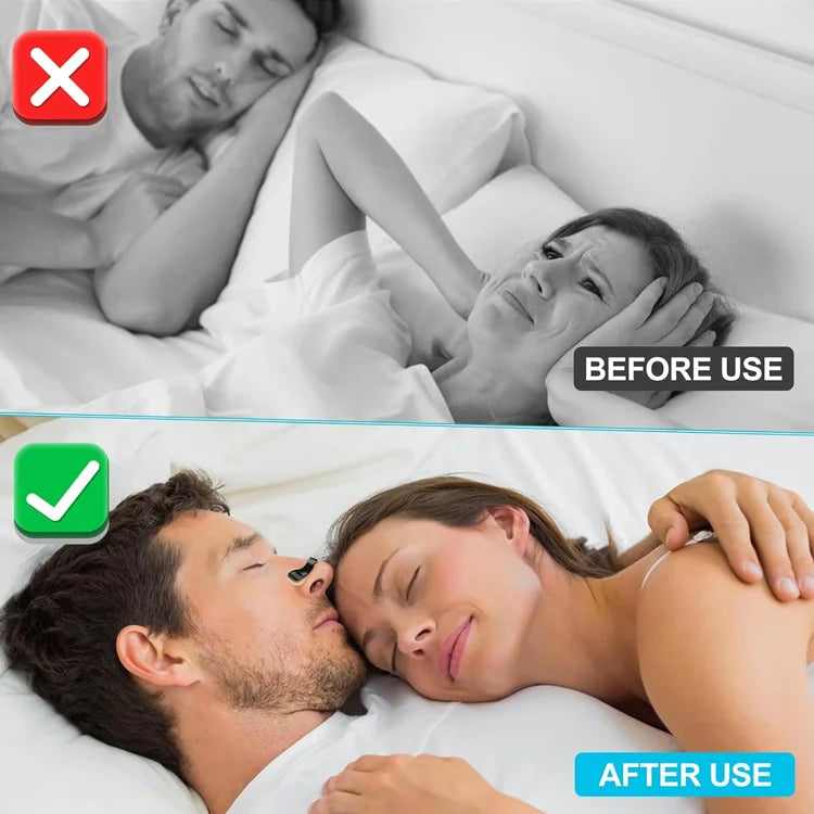 Eicgo Magnetic Nasal Dilator Strips