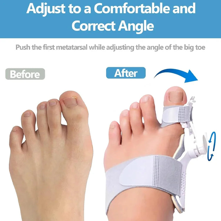 Eicgo Bunion Corrector for Women & Men