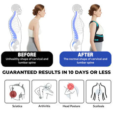 Eicgo™ Adjustable Posture Corrector Belt